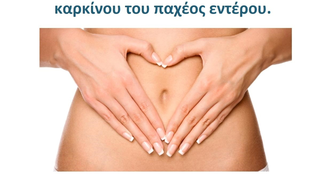 Eκστρατεία κατά του καρκίνου του παχέος εντέρου